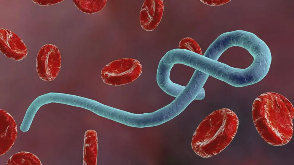 Ebola: Over 1,000 people infected in Congo Ebola: Over 1,000 people infected in Congo