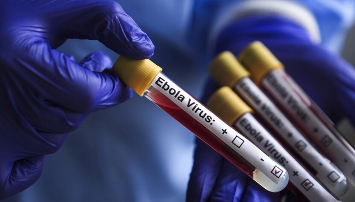 France confirms first case of Ebola in patient who visited Republic of Congo France confirms first case of Ebola in patient who visited Republic of Congo