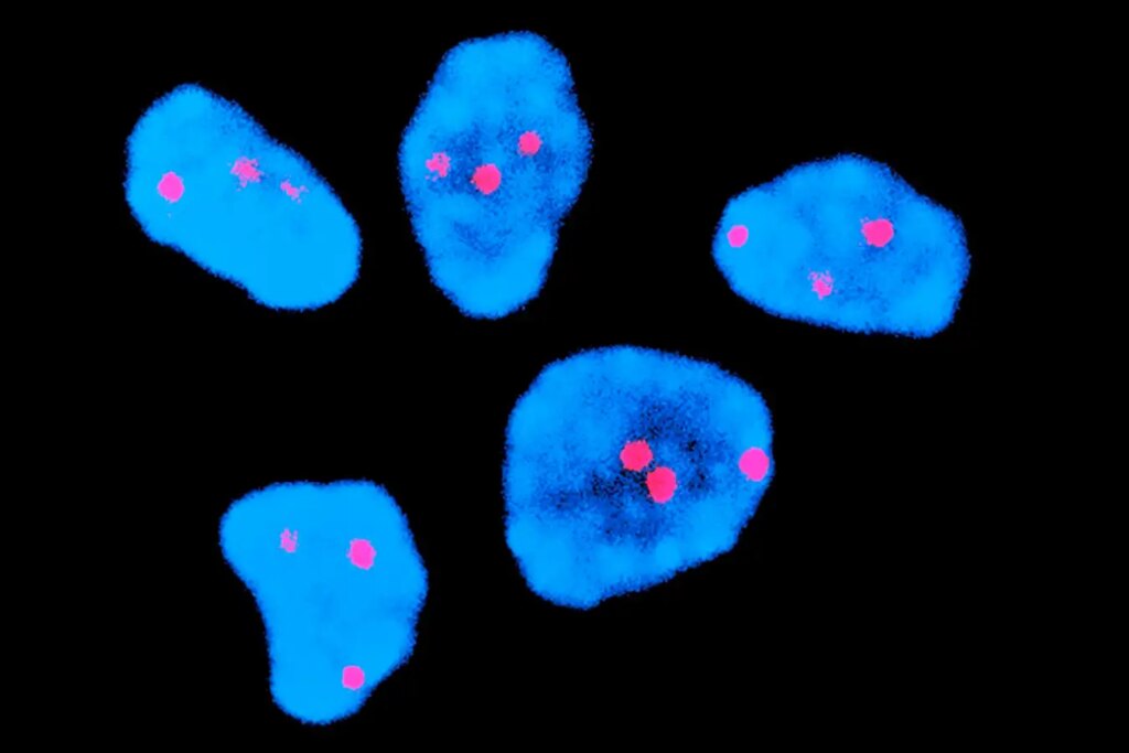 Injection halves risk of chromosome error common in older human eggs Injection halves risk of chromosome error common in older human eggs
