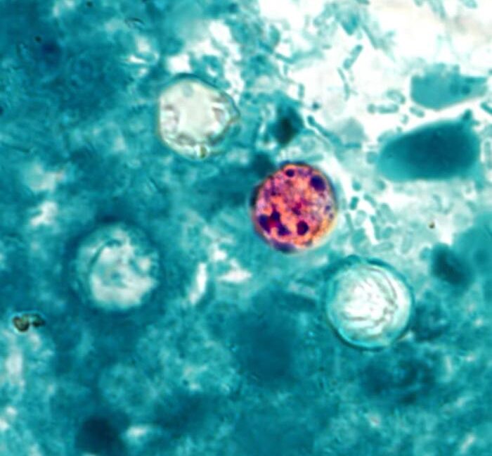 Michigan sees explosive outbreak of diarrheal parasite with over 700 cases Michigan sees explosive outbreak of diarrheal parasite with over 700 cases