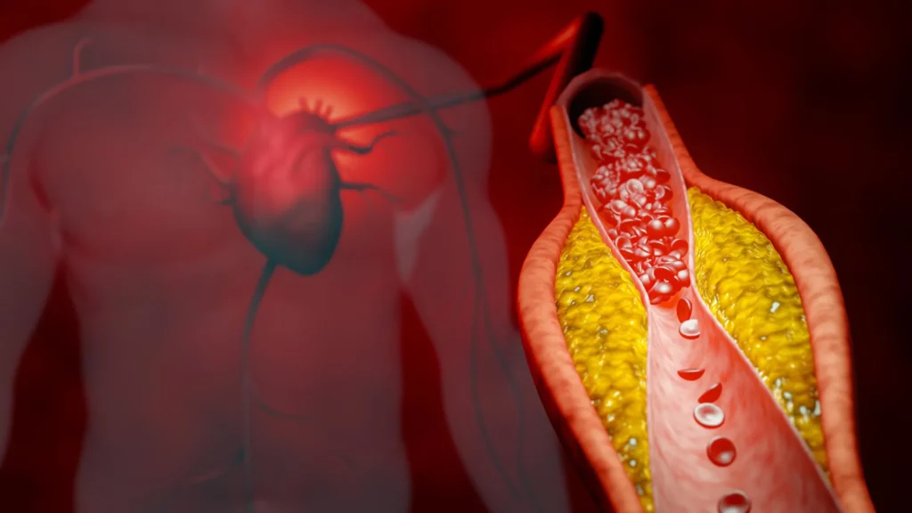 Millions may be getting the wrong cholesterol test Millions may be getting the wrong cholesterol test