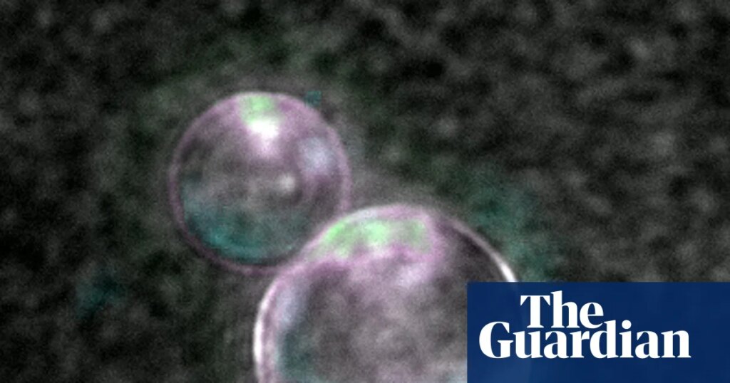 ‘Beautiful blobs’: synthetic life a step closer as scientists make cells using lab-made DNA | Science ‘Beautiful blobs’: synthetic life a step closer as scientists make cells using lab-made DNA | Science