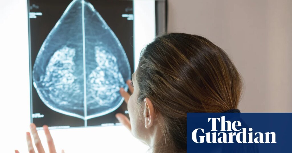 AI can detect heart disease in women using mammograms, study suggests | Women’s health