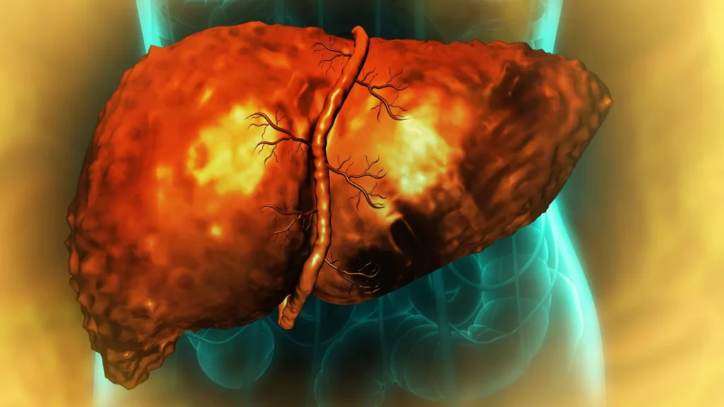 Scientists find why the liver may not heal even after you stop drinking