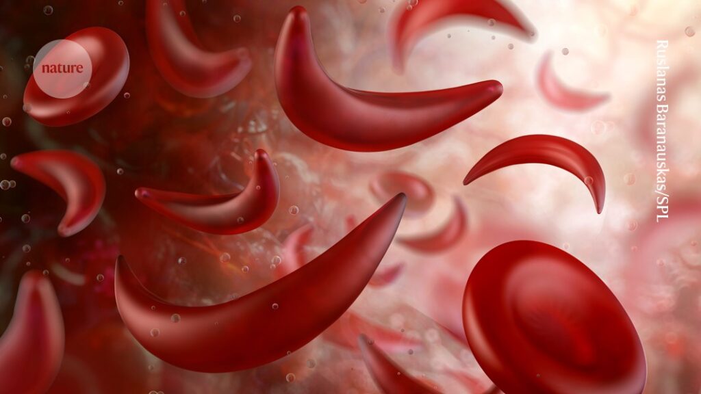 Sickle-cell disease linked to prematurely aged stem cells in mice