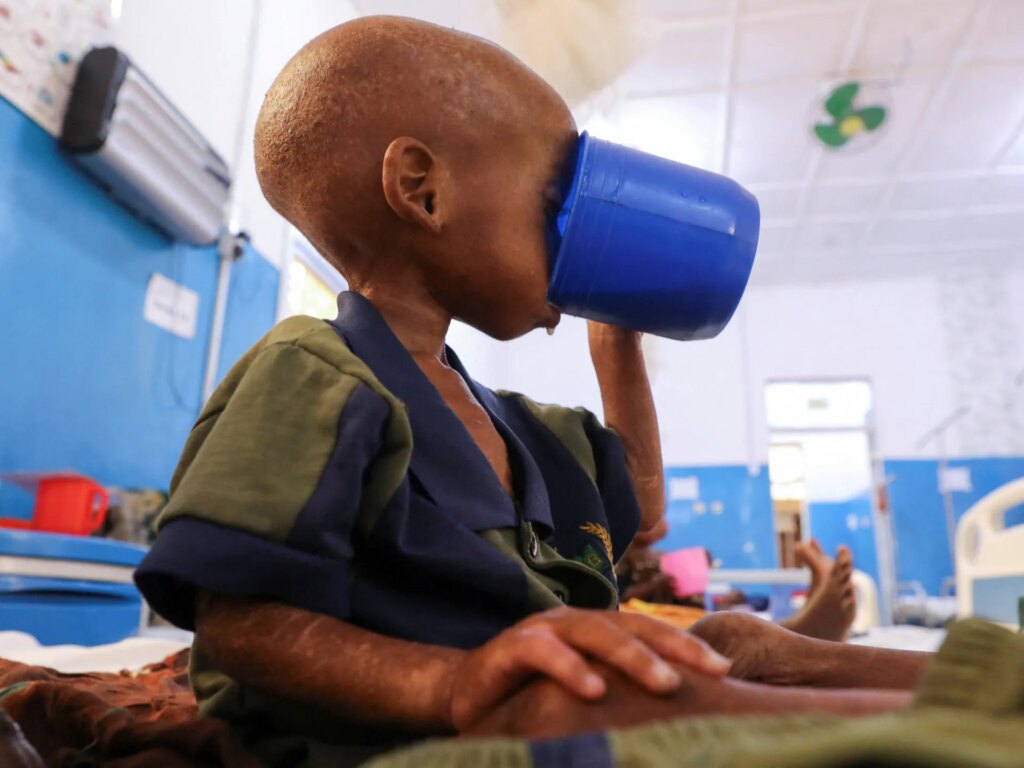 Somalia child hunger crisis deepens after aid cuts, UNICEF says | Hunger News