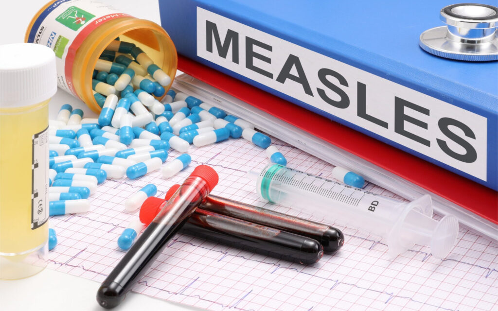 US records highest measles infections in 35 years US records highest measles infections in 35 years