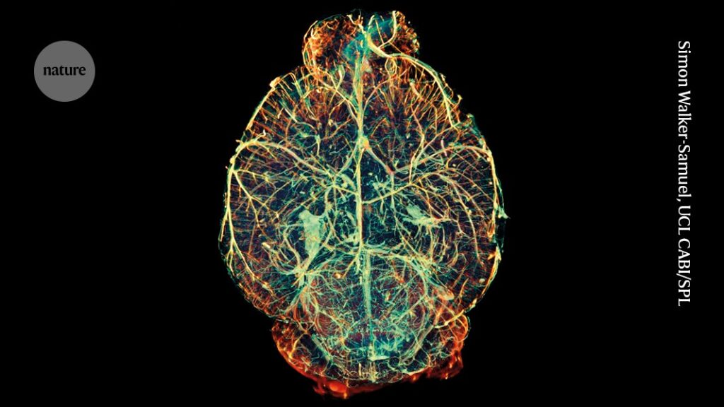 How to make a brain: new experiments challenge existing picture How to make a brain: new experiments challenge existing picture