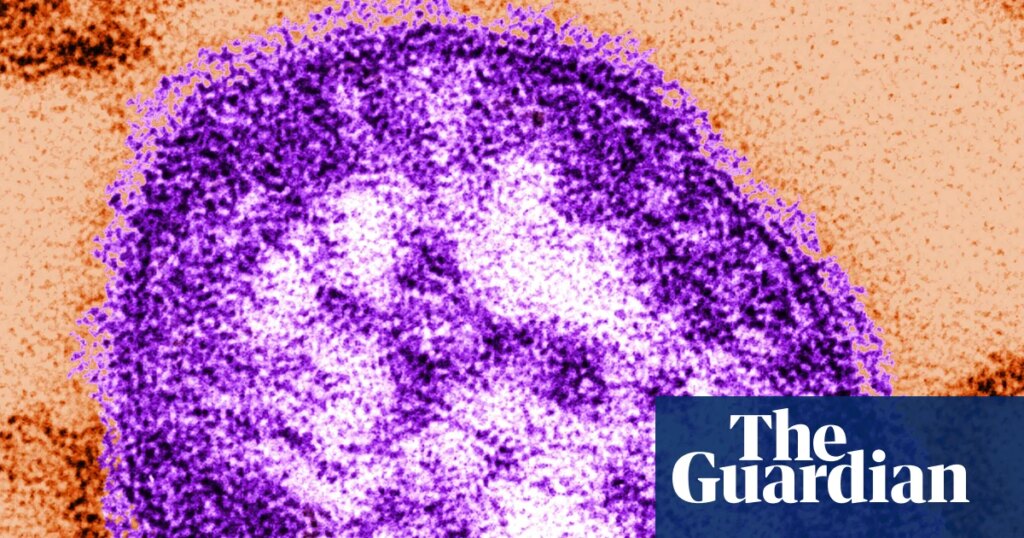 Six-week-old child in Pennsylvania dies from measles, coroner says | Pennsylvania Six-week-old child in Pennsylvania dies from measles, coroner says | Pennsylvania